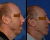 Art of Facial Surgery