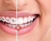 Baby & Rojas Certified Orthodontic Specialists - Goderich,ON