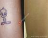 Extinkt Tattoo Removal & Skin Clinic