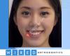 Wired Orthodontics